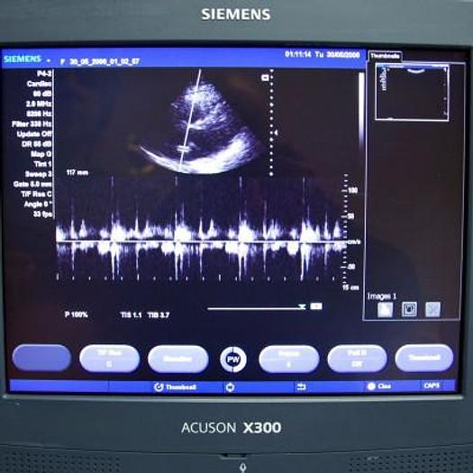 Used SIEMENS ACUSON X300 ULTRASOUND SCANNER WITH 3 PROBES AND FLAT SCREEN