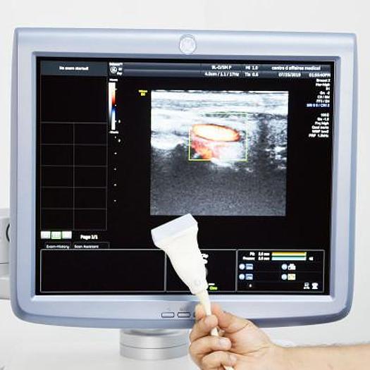 Used VOLUSON E8 GENERAL ELECTRIC RADIO GYNECO