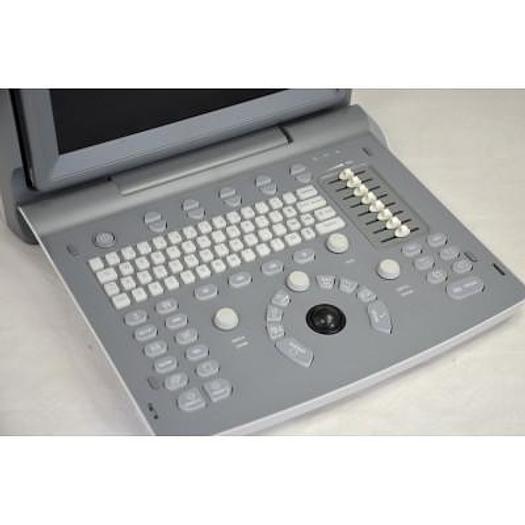 CHISON ECO1 PORTABLE ULTRASOUND WITH ABDOMINAL PROBE
