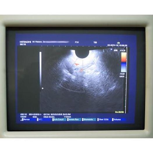 Used HITACHI HI VISION PREMIUM PLATFORM ULTRASOUND WITH 3 PROBES