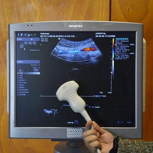 Used SIEMENS ACUSON S1000 ULTRASOUND SCANNER
