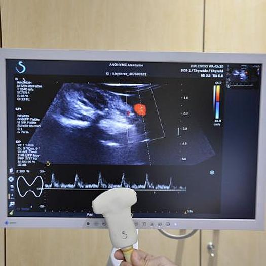 Used SUPERSONIC IMAGINE AIXPLORER ULTRASOUND SCANNER