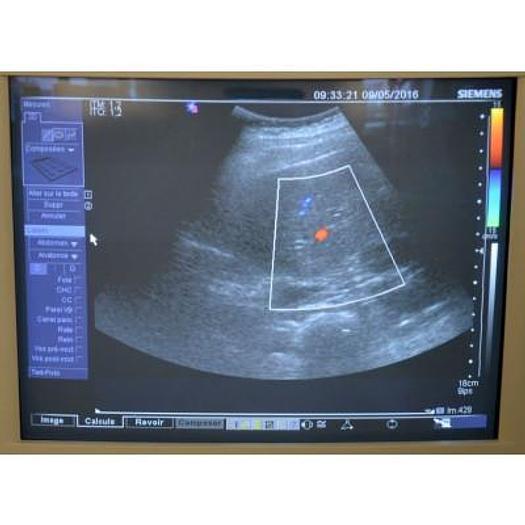 Used ABDOMINAL PROBE SIEMENS CH6-2