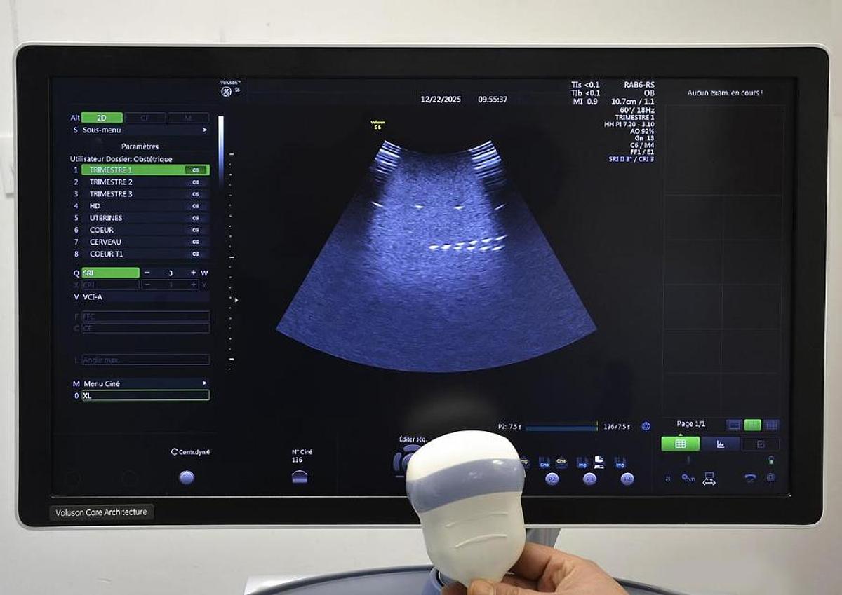 D'occasion GENEAL ELECTRIC VOLUSON S6 ULTRASOUND UNIT