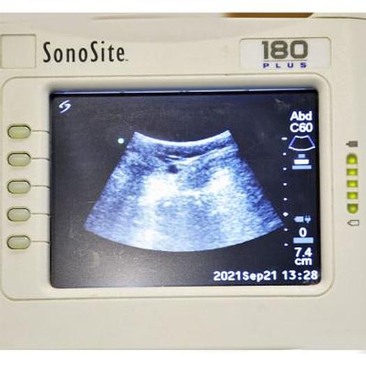 Used SONOSITE 180 PORTABLE ULTRASOUND SCANNER WITH CONVEX ABDOMINAL AND LINEAR SUPERFICIAL PROBES