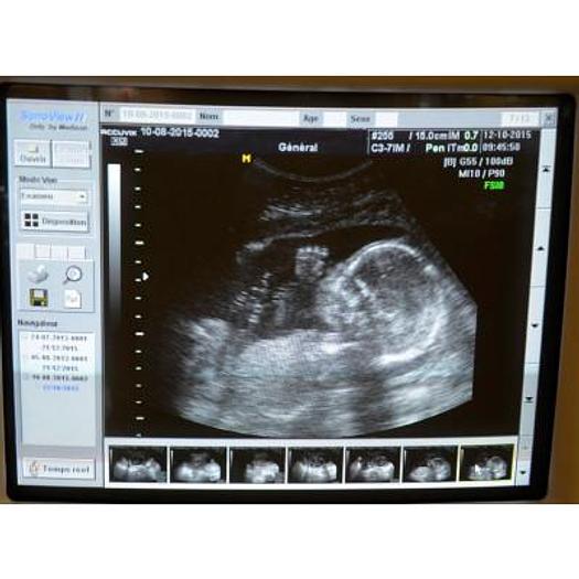 Used ACCUVIX XQ 3D/4D ULTRASOUND SCANNER WITH 4 PROBES