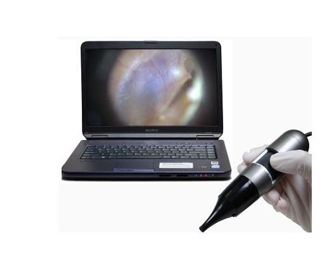 DIGITAL OTOSCOPE VIDEO OTOSCOPE EARSCOPE PRO, DINO-LITE