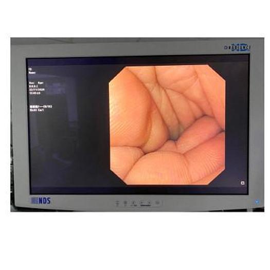 Used VIDEO GASTROSCOPE OLYMPUS GIF 130