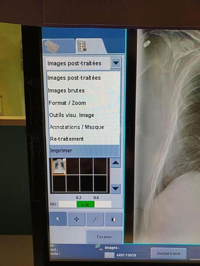 Used RADIO ROOM BONE LUNG GENERAL ELECTRIC DEFINIUM 5000