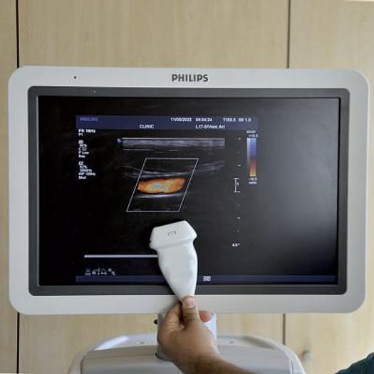 Used PHILIPS IU22 VASCULAR ULTRASOUND SCANNER