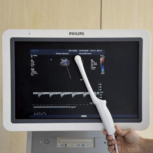 Used PHILIPS IU22 RADIO + CARDIO + GYNECO ECHOCARDIOGRAPH