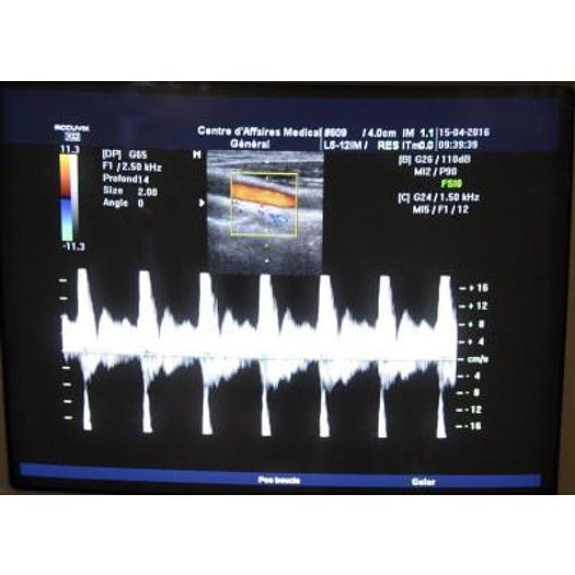 Used ACCUVIX XQ 3D/4D ULTRASOUND SCANNER WITH 4 PROBES