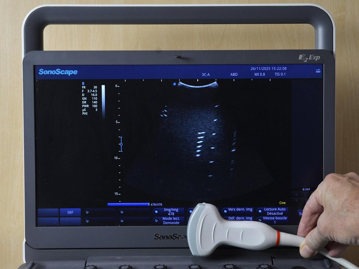 original-d-occasion-echographe-sonoscape-x3-exp.jpg