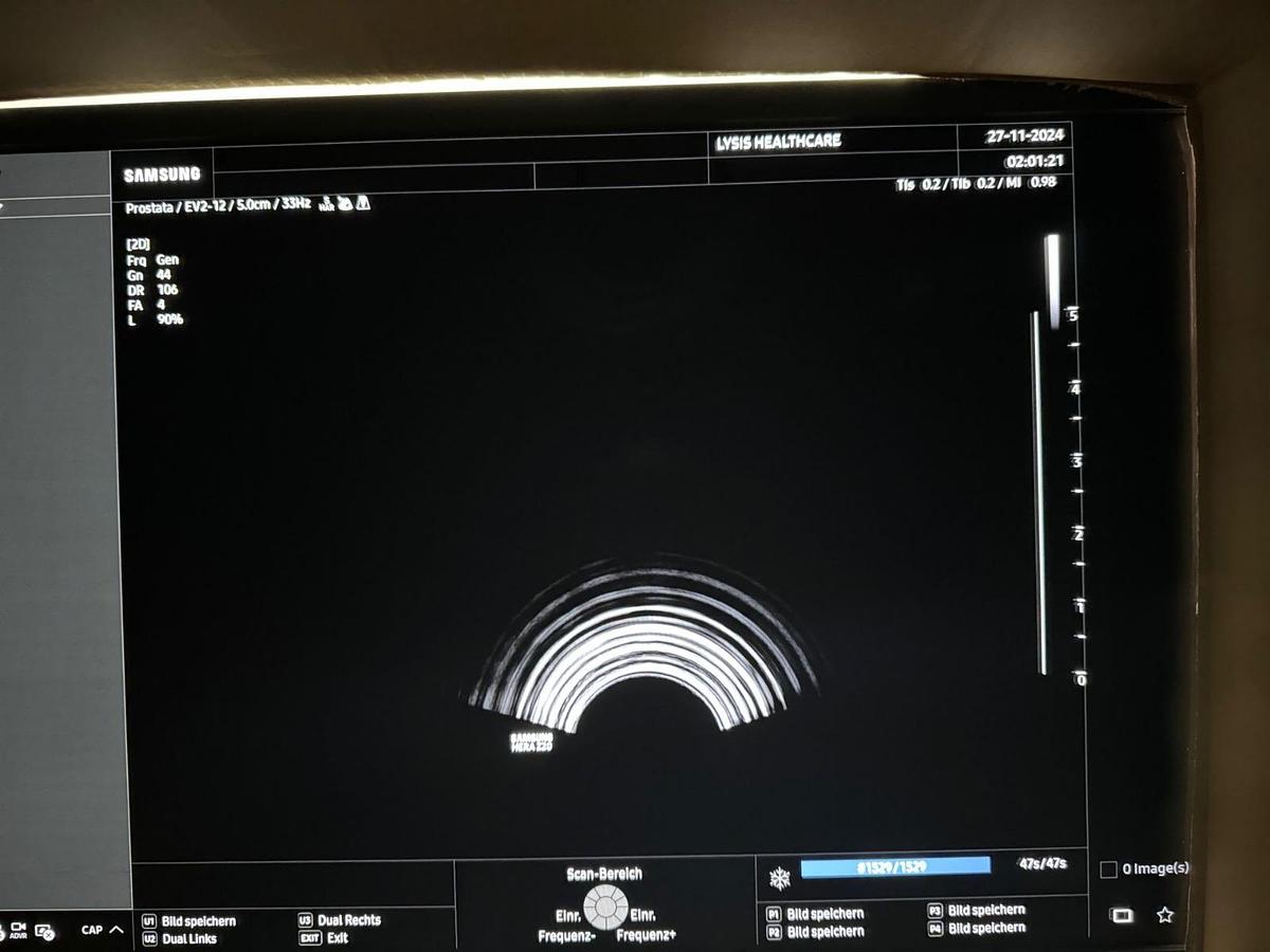 Rénové SAMSUNG Z20 ULTRASOUND