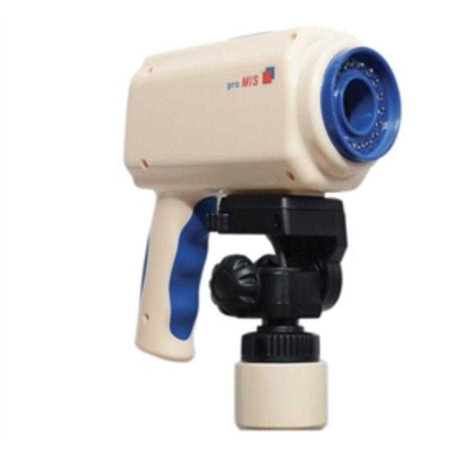 DIGITAL VIDEO COLPOSCOPE