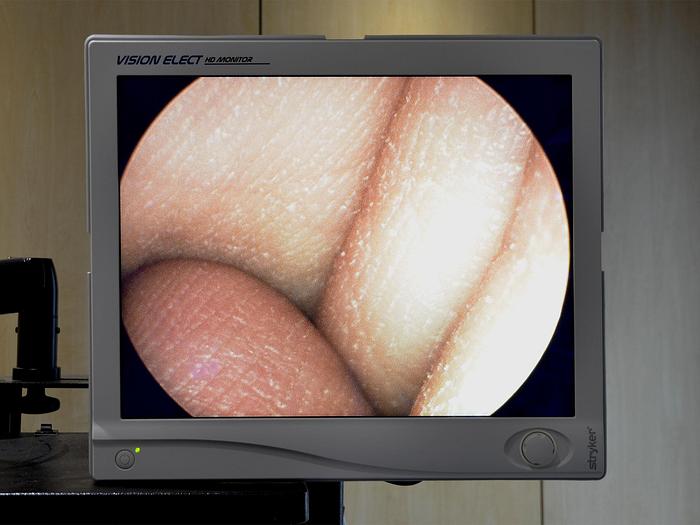 Used OLYMPUS 30° COELIOSCOPY SET