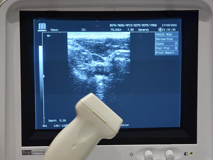 original-d-occasion-echographe-mindray-dp-6600.JPG