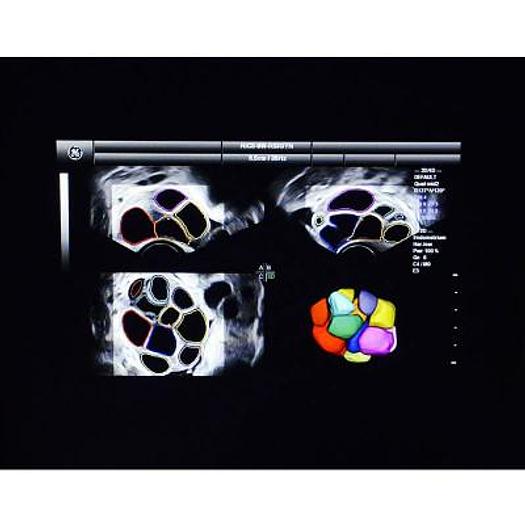 Used VOLUSON S8 HEALTHCARE 3D/4D GE ULTRASOUND SCANNER