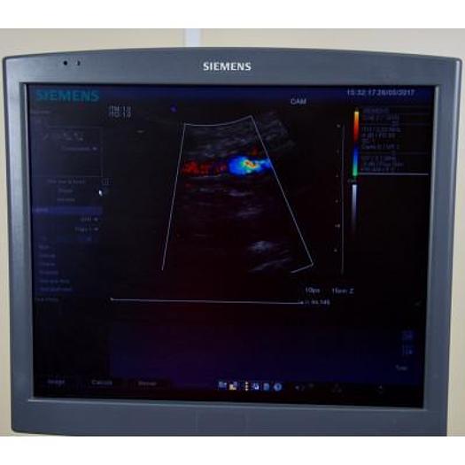 Used SIEMENS ANTARES 5.0 SONOLINE COLOR DOPPLER ULTRASOUND SCANNER