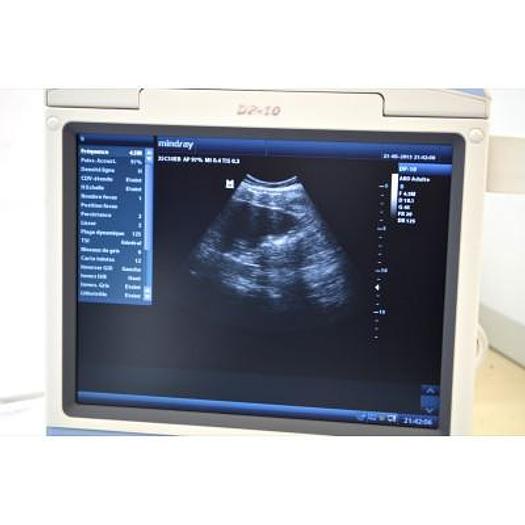 MINDRAY DP-10 ULTRASOUND SCANNER WITH LED MONITOR AND 1 CONVEX PROBE