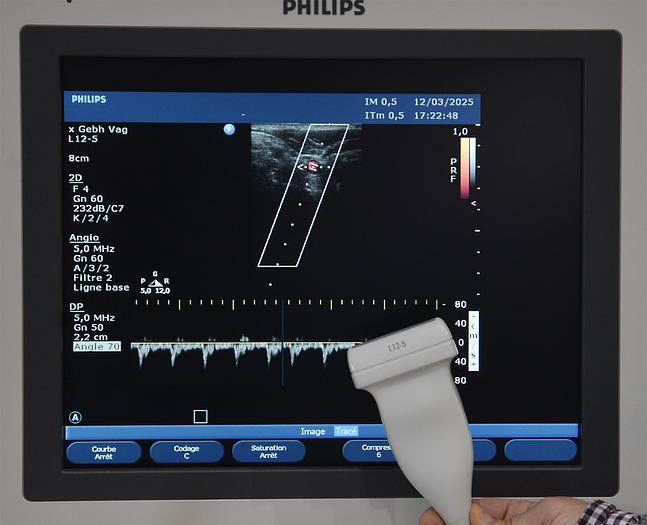 original-d-occasion-echographe-philips-hd-11-xe.JPG