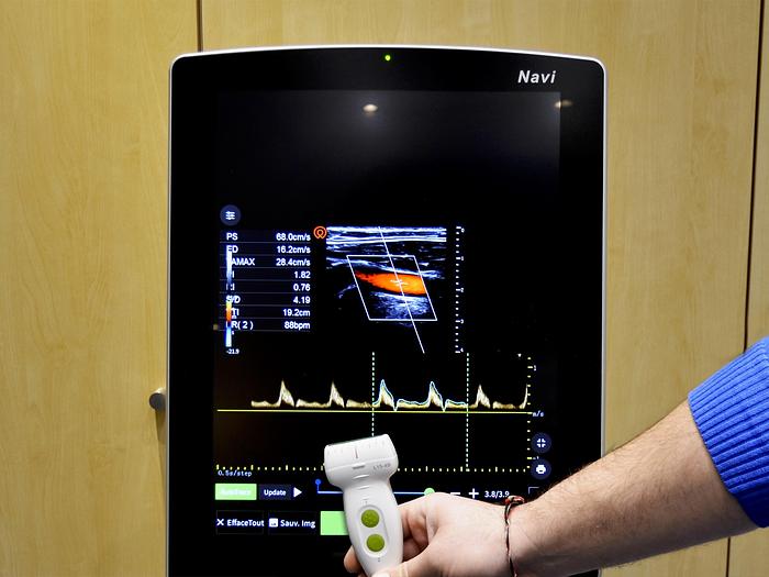 D'occasion ECHOGRAPHE WISONIC NAVI