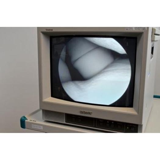Used VIDEO OTOSCOPE ALINA ON CABINET WITH SONY 15" SCREEN