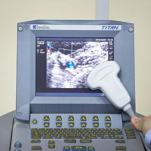 Used SONOSITE PORTABLE ULTRASOUND