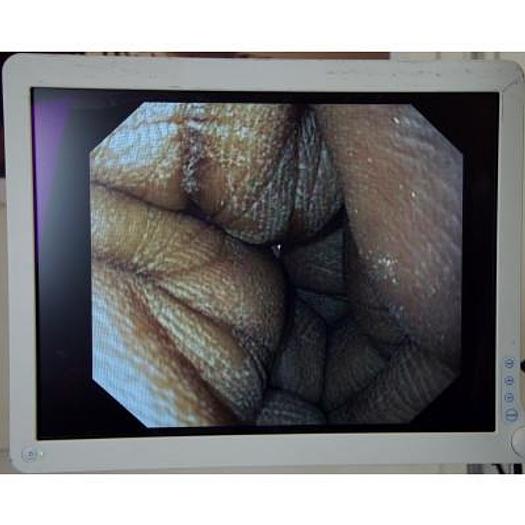 Used OLYMPUS GASTROSCOPY COLUMN WITH FLAT SCREEN 180 SERIES