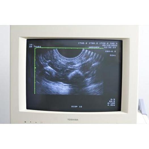 Used TOSHIBA POWERVISION 6000 ECHOCARDIOGRAPH WITH 3 PROBES