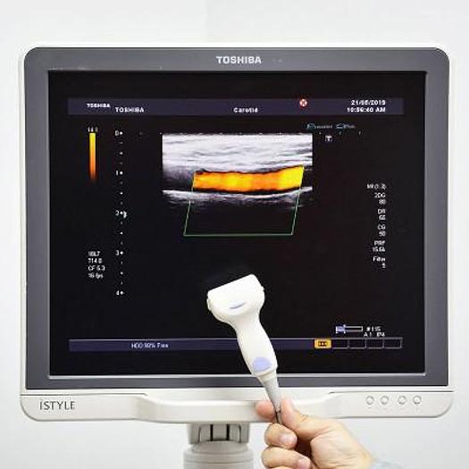TOSHIBA APLIO ULTRASOUND SCANNER (SSA-780A) COLOR DOPPLER FLAT SCREEN