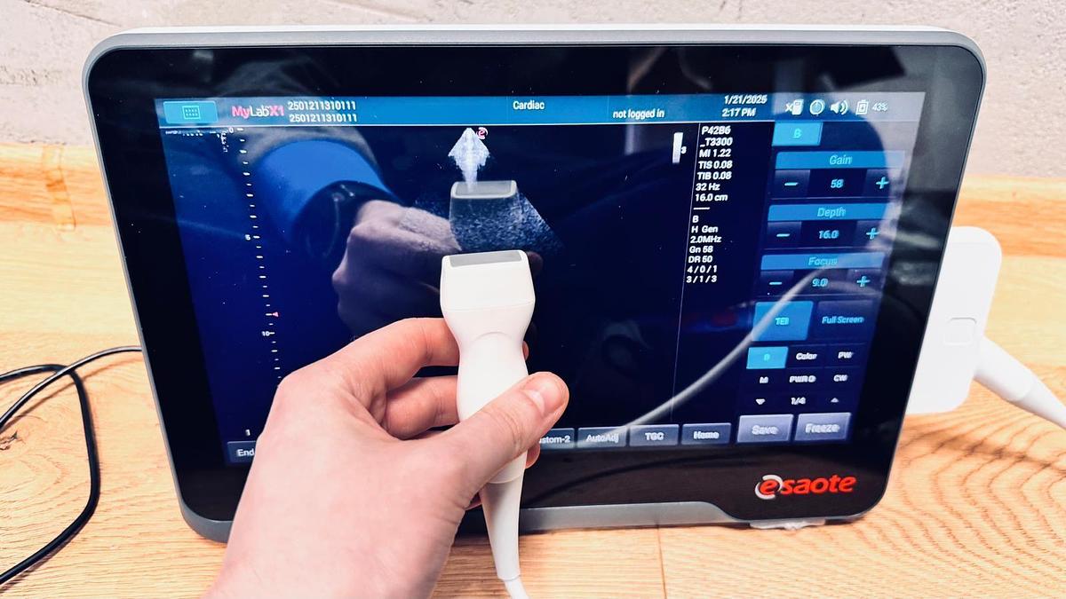 D'occasion ECHOGRAPHE MYLAB X1 AVEC 3 SONDES