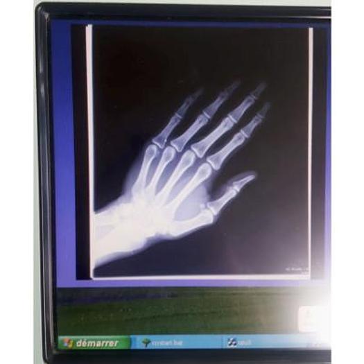 Used COMPACT IMAGE INTENSIFIER GENERAL ELECTRIC OEC 7700