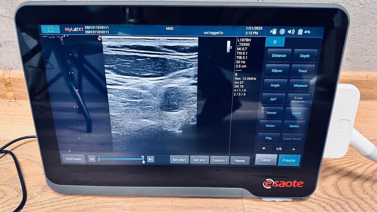 D'occasion ECHOGRAPHE MYLAB X1 AVEC 3 SONDES