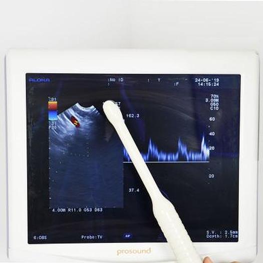 Used ALOKA PROSOUND ALPHA 6 ULTRASOUND SCANNER WITH 2 PROBES