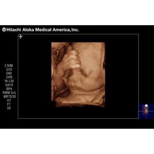 Used ALOKA/HITACHI PROSOUND 3500SX COLOR 3D/4D DOPPLER ULTRASOUND SCANNER
