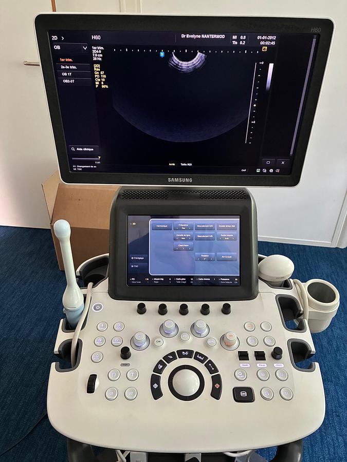 Rénové ECHOGRAPHE SAMSUNG UGEO HS60