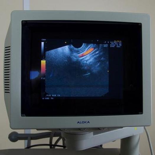 Used ALOKA PROSOUND 5500 COLOR DOPPLER ULTRASOUND WITH ABDOMINAL PROBE AND ENDOVAGINAL PROBE