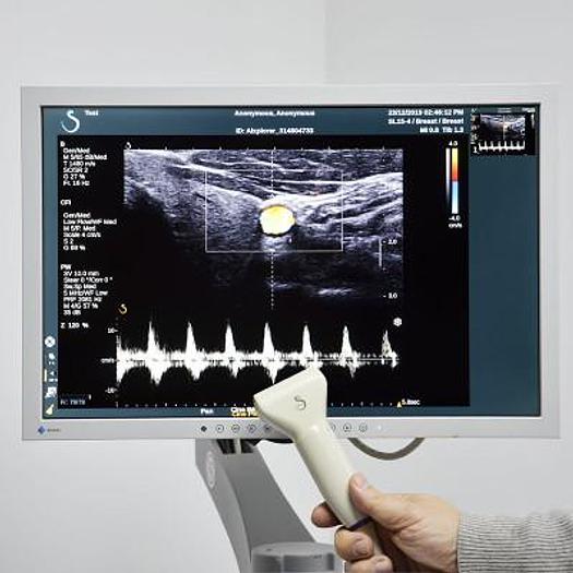 Used IMAGINE AIXPLORER SUPERSONIC ULTRASOUND (MADE IN FRANCE)