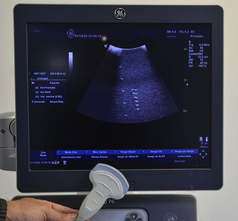 D'occasion GE LOGIQ P6 ULTRASOUND with 2 probes