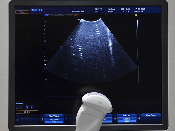 Used PHILIPS HD9 3D/4D ULTRASOUND with 4 PROBES
