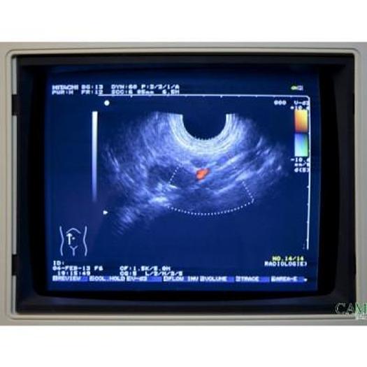 Used HITACHI EUB 525 COLOR DOPPLER ULTRASOUND WITH 2 PROBES