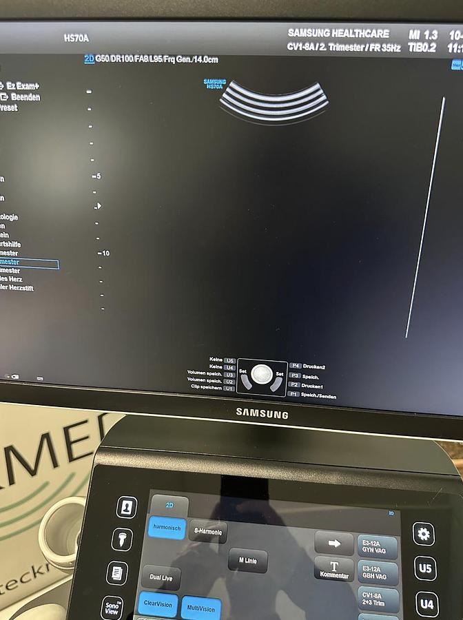 D'occasion ECHOGRAPHE SAMSUNG HS 70