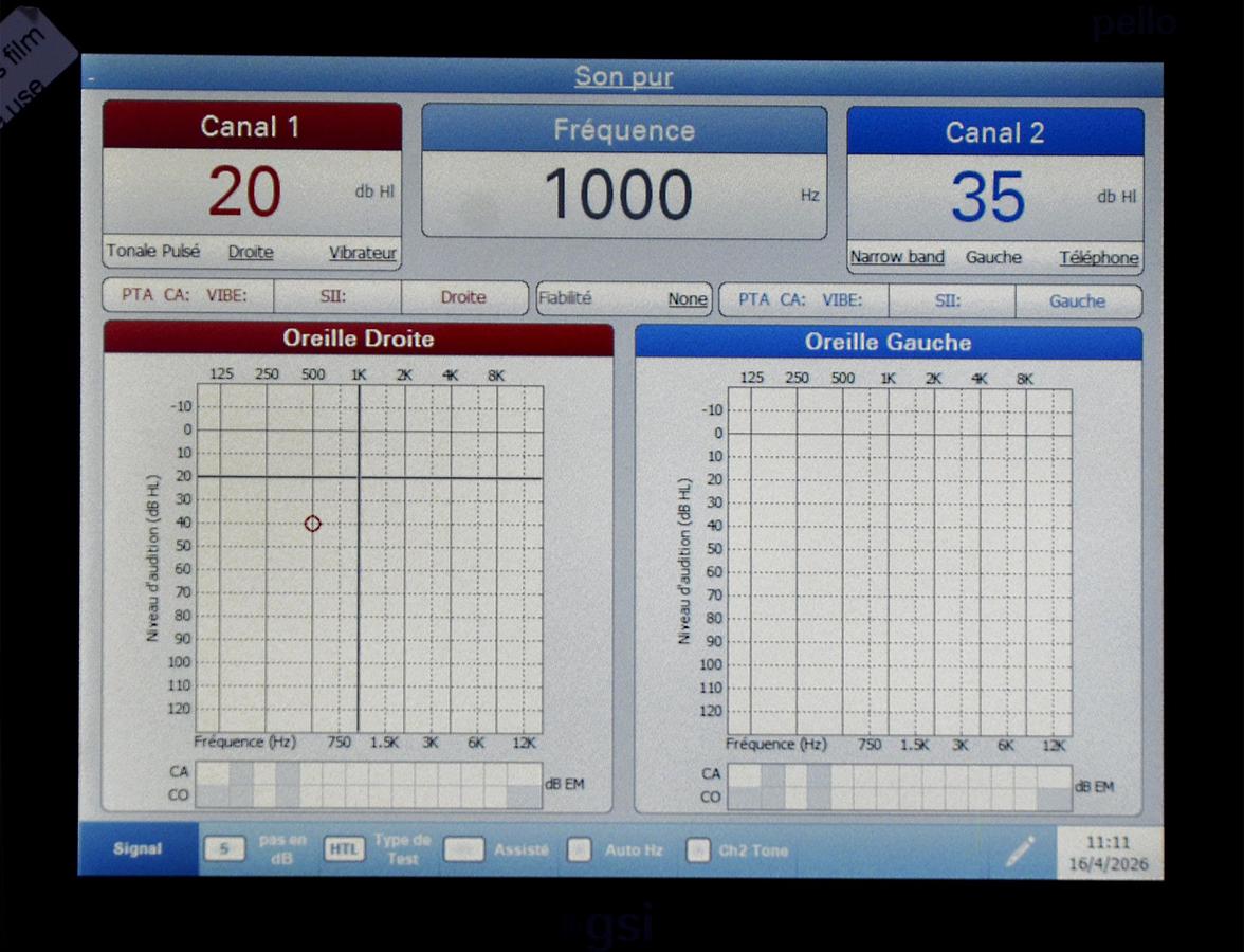 D'occasion GRASON-STADLER PELLO GSI AUDIOMETER