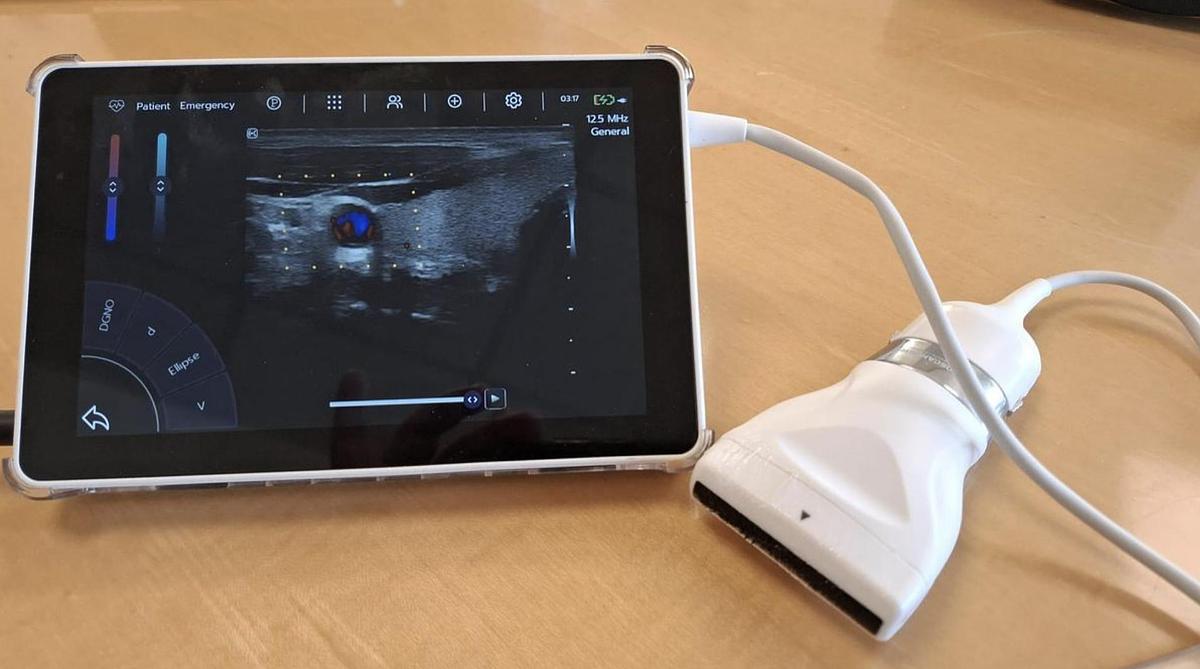 D'occasion ECHOGRAPHE SUPER PORTABLE SONOSCANNER U-LITE PRO AVEC 3 sondes interchangeables : convexe, lineaire, cardiaque