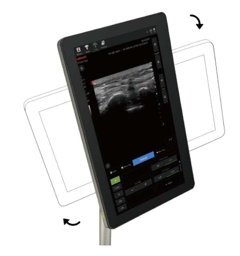 ECHOGRAPHE WISONIC PILOTER