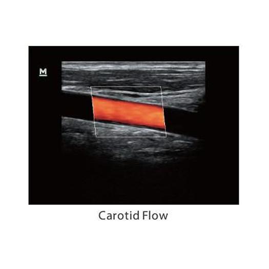 MINDRAY Z5 COLOR DOPPLER SYSTEM