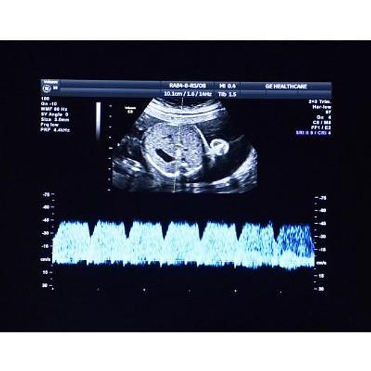 Used VOLUSON S8 HEALTHCARE 3D/4D GE ULTRASOUND SCANNER