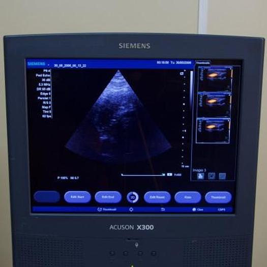 Used SIEMENS ACUSON X300 ULTRASOUND SCANNER WITH 3 PROBES AND FLAT SCREEN