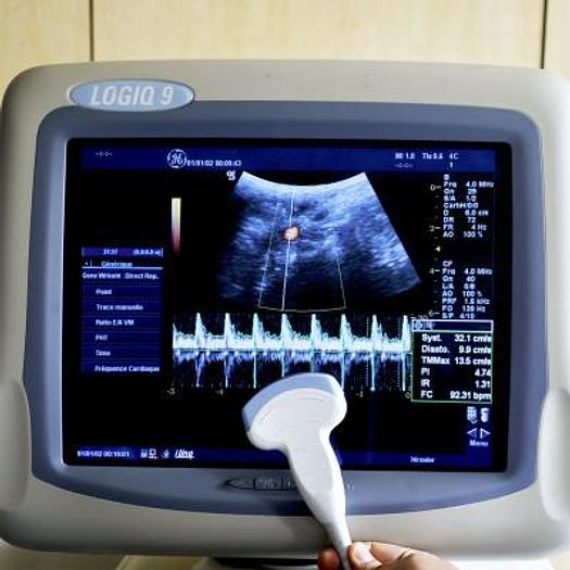 Used LOGIQ 9 GENERAL ELECTRIC ULTRASOUND